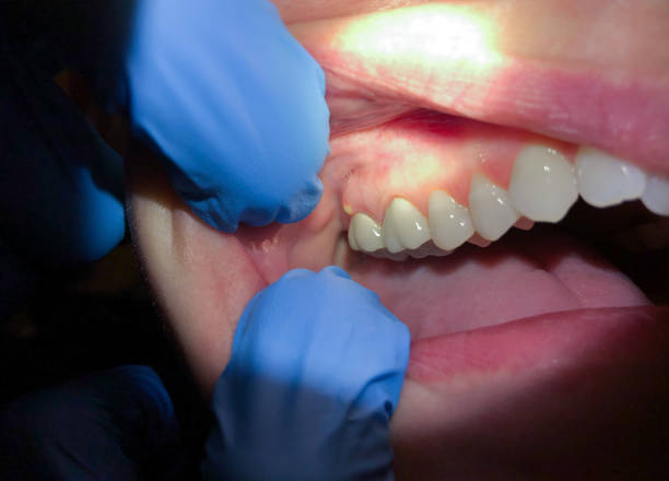  Warner Robins, GA Emergency Dentist Pros